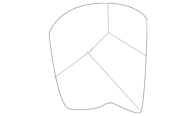 9889125 - : Dowel for Mercedes-Benz: ML320, ML430, ML55 AMG Image